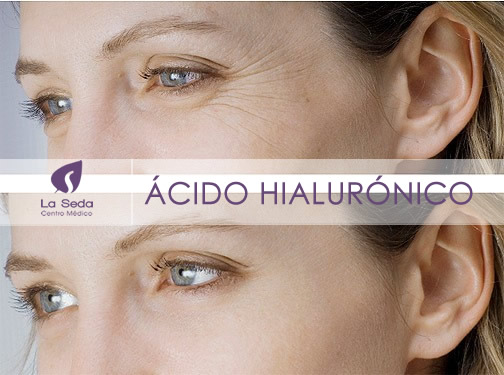 Ácido Hialurónico La Seda Centro Médico