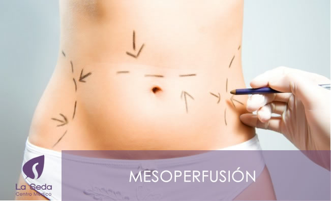 Mesoperfusión - Centro Médico La Seda