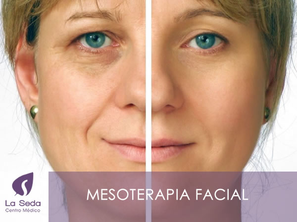 Mesoterapia Facial - La Seda Centro Médico