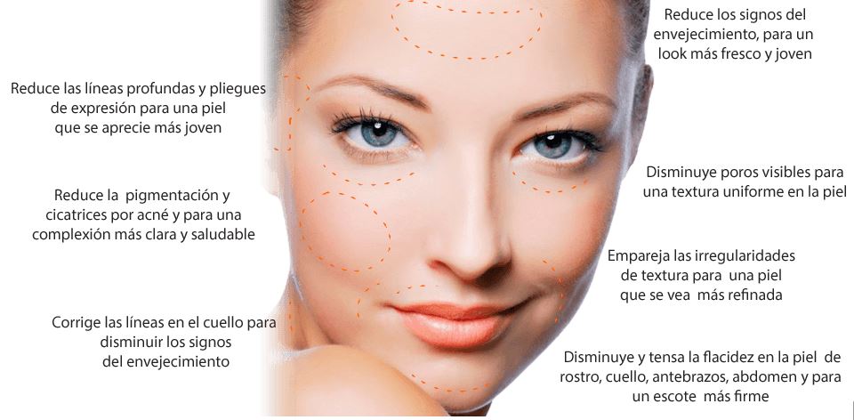 CARBOXITERAPIA FACIAL