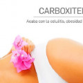 Carboxiterapia