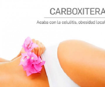 Carboxiterapia