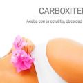 Carboxiterapia